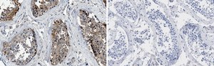 Anti-PKM2 Antibody, clone 1B2 ZooMAb&#174; Rabbit Monoclonal recombinant, expressed in HEK 293 cells