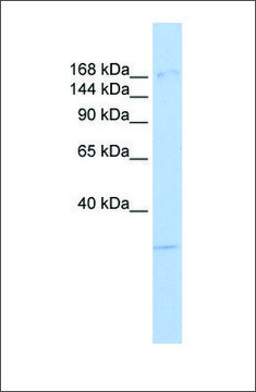 Anti-UTX antibody produced in rabbit affinity isolated antibody