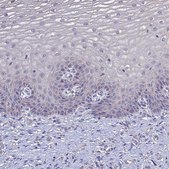 Anti-SLC26A4 antibody produced in rabbit Prestige Antibodies&#174; Powered by Atlas Antibodies, affinity isolated antibody, buffered aqueous glycerol solution