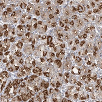 Anti-ABTB1 antibody produced in rabbit Prestige Antibodies&#174; Powered by Atlas Antibodies, affinity isolated antibody, buffered aqueous glycerol solution