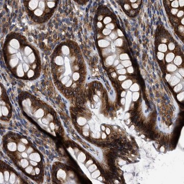 Anti-FAM120A antibody produced in rabbit Prestige Antibodies&#174; Powered by Atlas Antibodies, affinity isolated antibody, buffered aqueous glycerol solution