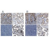 Anti-ACADVL antibody produced in rabbit Prestige Antibodies&#174; Powered by Atlas Antibodies, affinity isolated antibody, buffered aqueous glycerol solution, Ab1