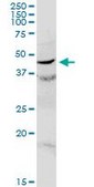 Anti-C17orf75 antibody produced in rabbit purified immunoglobulin, buffered aqueous solution