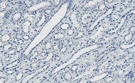 Anti-KIF5B Antibody, clone 2F23 ZooMAb&#174; Rabbit Monoclonal recombinant, expressed in HEK 293 cells