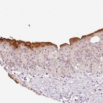 Anti-SLC29A3 antibody produced in rabbit Prestige Antibodies&#174; Powered by Atlas Antibodies, affinity isolated antibody, buffered aqueous glycerol solution