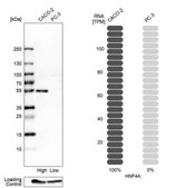 Anti-HNF4A antibody produced in rabbit Prestige Antibodies&#174; Powered by Atlas Antibodies, affinity isolated antibody, buffered aqueous glycerol solution
