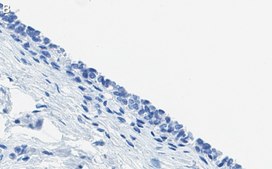Anti-ErbB2/HER-2 Antibody, clone 1B13 ZooMAb&#174; Rabbit Monoclonal recombinant, expressed in HEK 293 cells