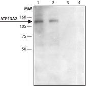 Anti-ATP13A2 (C-terminal region) antibody produced in rabbit ~1.5&#160;mg/mL, affinity isolated antibody, buffered aqueous solution