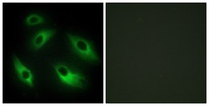 Anti-EPHB6 antibody produced in rabbit affinity isolated antibody