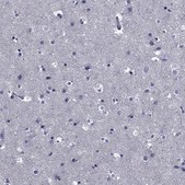 Anti-MGARP antibody produced in rabbit Prestige Antibodies&#174; Powered by Atlas Antibodies, affinity isolated antibody, buffered aqueous glycerol solution
