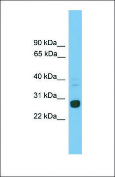Anti-Mxd1 antibody produced in rabbit affinity isolated antibody
