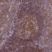 Anti-IRAK3 antibody produced in rabbit Prestige Antibodies&#174; Powered by Atlas Antibodies, affinity isolated antibody, buffered aqueous glycerol solution
