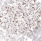 Monoclonal Anti-PAX2 antibody produced in mouse Prestige Antibodies&#174; Powered by Atlas Antibodies, clone CL9469, purified immunoglobulin, buffered aqueous glycerol solution