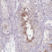 Anti-SLC30A3 antibody produced in rabbit Prestige Antibodies&#174; Powered by Atlas Antibodies, affinity isolated antibody, buffered aqueous glycerol solution