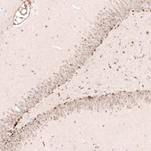 Monoclonal Anti-SOX4 antibody produced in mouse Prestige Antibodies&#174; Powered by Atlas Antibodies, clone CL5665, purified immunoglobulin, buffered aqueous glycerol solution