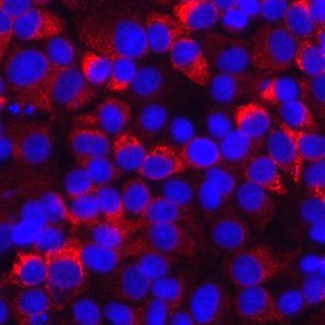 Anti-Hepatitis C Virus Antibody, helicase domain NS3 Chemicon&#174;, from mouse