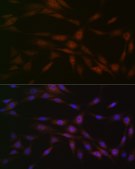 Anti-Casein Kinase 2 beta (CSNK2B) Antibody, clone 9T5J10, Rabbit Monoclonal