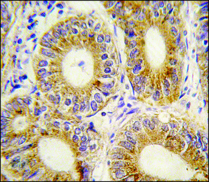 Anti-YARS2 (C-term) antibody produced in rabbit saturated ammonium sulfate (SAS) precipitated, buffered aqueous solution