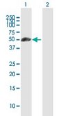 Anti-KRT7 antibody produced in mouse purified immunoglobulin, buffered aqueous solution