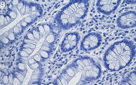 Anti-CD167a/DDR1 Antibody, clone 1D11 ZooMAb&#174; Rabbit Monoclonal recombinant, expressed in HEK 293 cells
