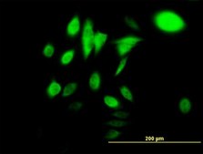 Monoclonal Anti-HSPA1B antibody produced in mouse clone 3B7, purified immunoglobulin, buffered aqueous solution
