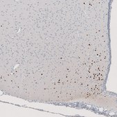 Monoclonal Anti-OTP antibody produced in mouse Prestige Antibodies&#174; Powered by Atlas Antibodies, clone CL11225, purified immunoglobulin, buffered aqueous glycerol solution