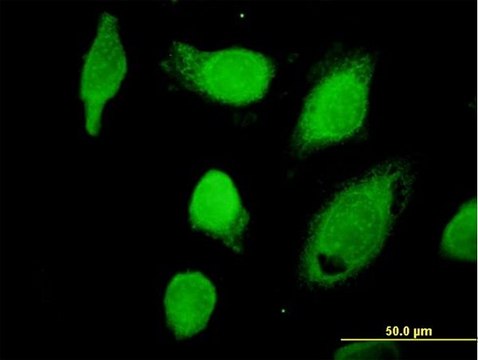 Anti-CAPN1 antibody produced in mouse purified immunoglobulin, buffered aqueous solution