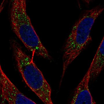 Anti-Bst2 Antibody Produced In Rabbit Prestige Antibodies&#174; Powered by Atlas Antibodies, affinity isolated antibody, buffered aqueous glycerol solution
