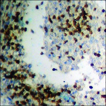 Anti-phospho-IRS-1 (pSer794) antibody produced in rabbit affinity isolated antibody