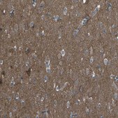 Anti-CMTM4 antibody produced in rabbit Prestige Antibodies&#174; Powered by Atlas Antibodies, affinity isolated antibody, buffered aqueous glycerol solution