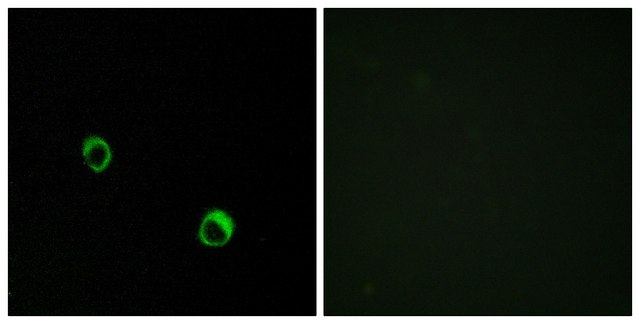 Anti-CAR14 antibody produced in rabbit affinity isolated antibody
