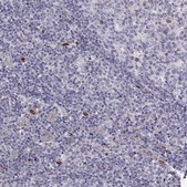 Anti-SLC9A3R2 Prestige Antibodies&#174; Powered by Atlas Antibodies, affinity isolated antibody