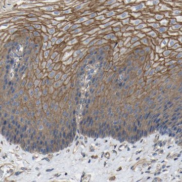 Anti-TNFSF15 antibody produced in rabbit Prestige Antibodies&#174; Powered by Atlas Antibodies, affinity isolated antibody, buffered aqueous glycerol solution