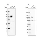 Anti-VIL1 antibody produced in rabbit Ab1, Prestige Antibodies&#174; Powered by Atlas Antibodies, affinity isolated antibody, buffered aqueous glycerol solution