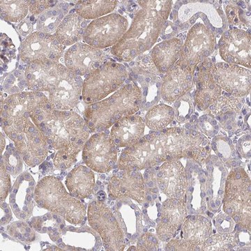 Anti-CEMP1 antibody produced in rabbit Prestige Antibodies&#174; Powered by Atlas Antibodies, affinity isolated antibody, buffered aqueous glycerol solution