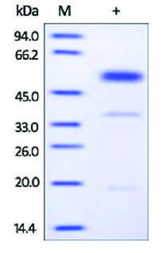 UPA human recombinant, expressed in HEK 293 cells, &#8805;95% (SDS-PAGE)