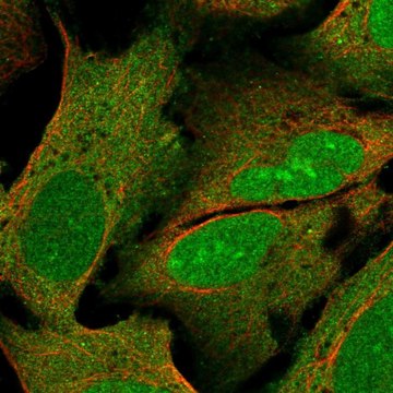 Anti-PYM1 antibody produced in rabbit Prestige Antibodies&#174; Powered by Atlas Antibodies, affinity isolated antibody