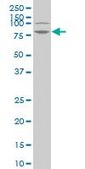 ANTI-LIMK1 antibody produced in mouse clone 2E9, purified immunoglobulin, buffered aqueous solution