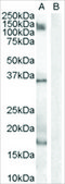 Anti-AIF1/IBA1 (Isoform 3) antibody produced in goat affinity isolated antibody, buffered aqueous solution