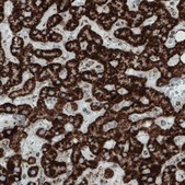 Monoclonal Anti-SDHB antibody produced in mouse Prestige Antibodies&#174; Powered by Atlas Antibodies, clone CL0349, purified immunoglobulin, buffered aqueous glycerol solution