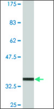 Monoclonal Anti-TREX1, (N-terminal) antibody produced in mouse clone 1B1, purified immunoglobulin, buffered aqueous solution