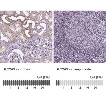 Anti-SLC2A9 antibody produced in rabbit Prestige Antibodies&#174; Powered by Atlas Antibodies, affinity isolated antibody, buffered aqueous glycerol solution