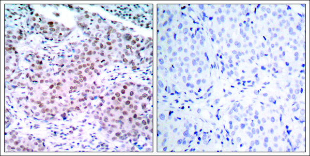 Anti-phospho-ESR1 (pSer104) antibody produced in rabbit affinity isolated antibody