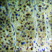Anti-phospho-BRCA1 (pSer1423) antibody produced in rabbit affinity isolated antibody