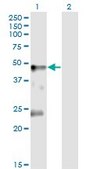 Monoclonal Anti-GLRA1 antibody produced in mouse clone 2E7, purified immunoglobulin, buffered aqueous solution