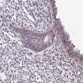 Anti-CARS2 antibody produced in rabbit Prestige Antibodies&#174; Powered by Atlas Antibodies, affinity isolated antibody, buffered aqueous glycerol solution