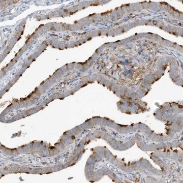 Anti-IFT57 antibody produced in rabbit Prestige Antibodies&#174; Powered by Atlas Antibodies, affinity isolated antibody, buffered aqueous glycerol solution