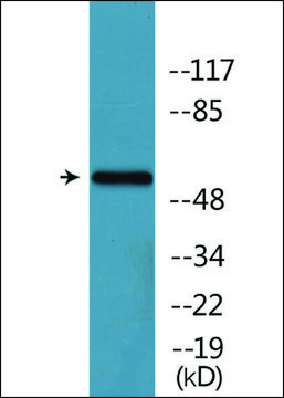 Anti-phospho-Tyrosine Hydroxylase (pSer31) antibody produced in rabbit affinity isolated antibody
