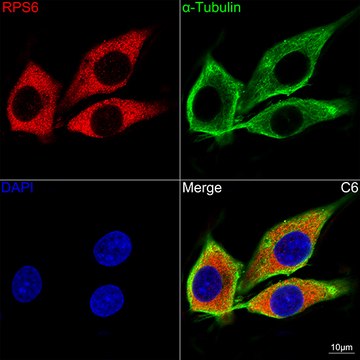 Anti-S6 Ribosomal Protein (RPS6) Antibody, clone 4C7P4, Rabbit Monoclonal