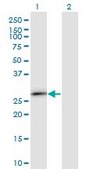 Monoclonal Anti-IGKC antibody produced in mouse clone 1F6, purified immunoglobulin, buffered aqueous solution